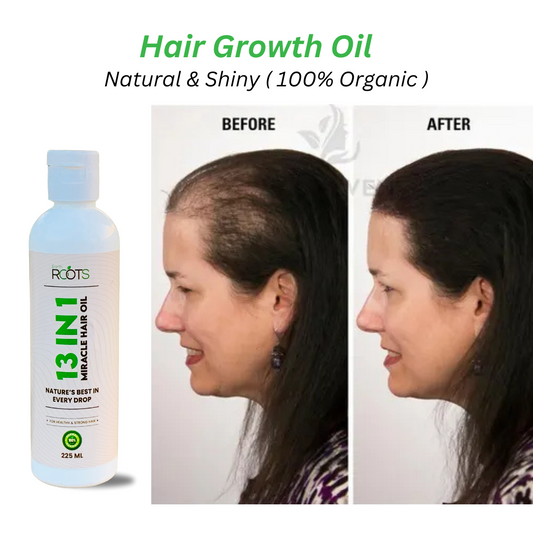 EarthRoots™ 13 in 1 Miracle Hair Oil | 100% Results