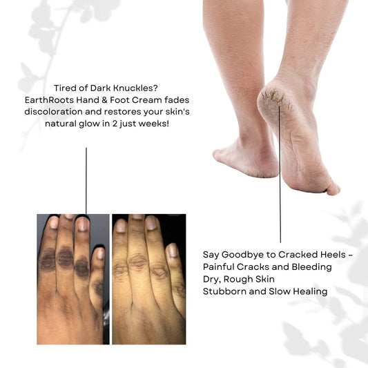 EarthRoots™ Hand & Feet Whitening Cream